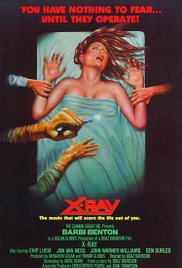 XRay (1981) Free Movie